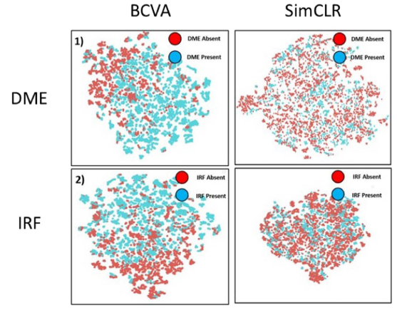 Clinically Labeled Contrastive Learning for OCT Biomarker Classification